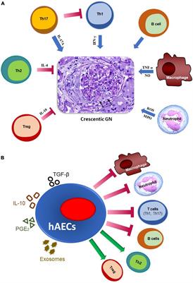 Crescentic Glomerulonephritis: Pathogenesis and Therapeutic Potential of Human Amniotic Stem Cells